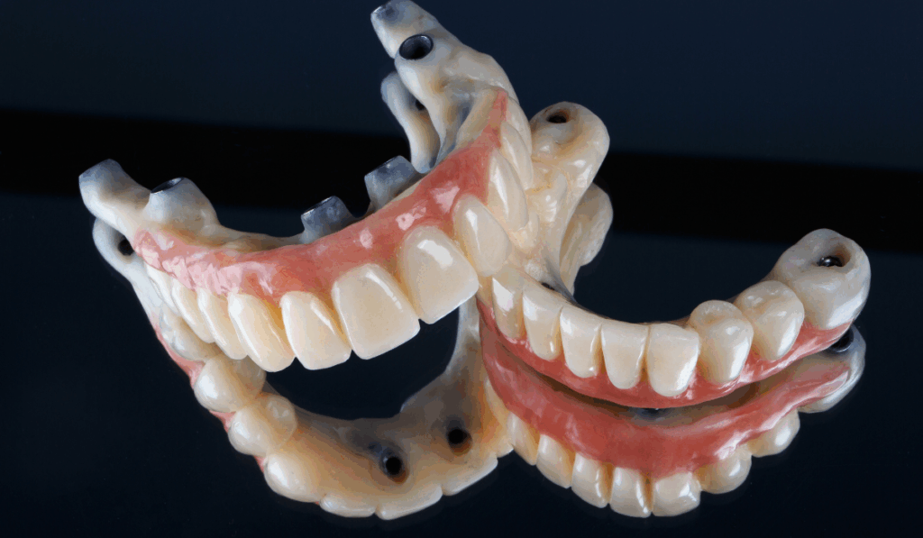 All on X oral hygiene cleaning techniques Luka Dental Implants London Ontario