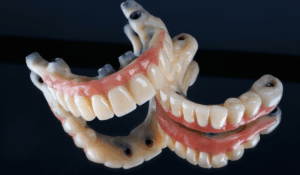 All on X oral hygiene cleaning techniques Luka Dental Implants London Ontario