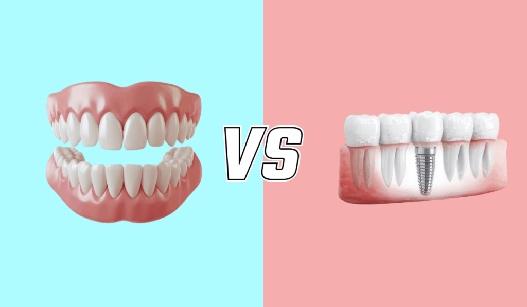Dental implants vs dentures comparison Luka Dental Implants London Ontario