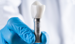 Dental implants in London age considerations Luka Dental Implants London Ontario